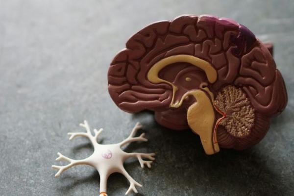 6 Ways to Minimise Unconscious Bias